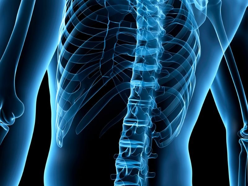 Tratamento da Compressao Radicular em Sao Paulo