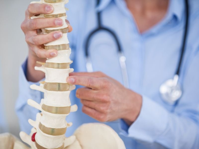 Tratamento da Escoliose Congenita em Sao Paulo