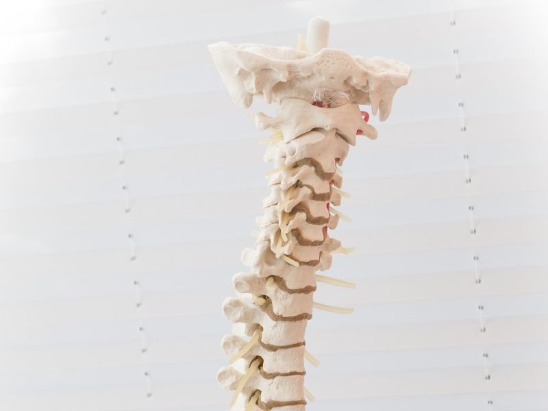 Tratamento da Espondilolise em Sao Paulo