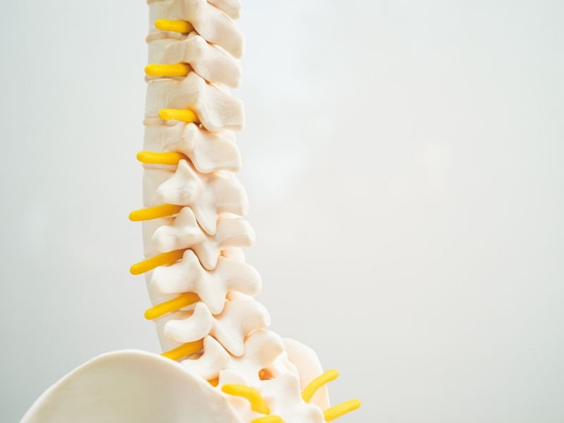 Tratamento da Rizotomia por Radiofrequencia em Sao Paulo