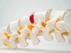 Cirurgia de hernia de disco Sao Paulo
