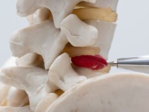Clinica com especialista em hernia de disco SP
