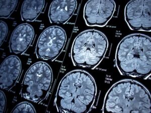 Clinica de neurocirurgia em Sao Paulo