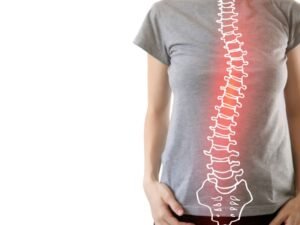 Especialista em escoliose Sao Paulo