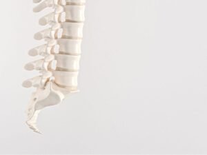 Especialista em espondilolistese Sao Paulo