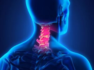 Especialista em hernia de disco cervical Sao Paulo