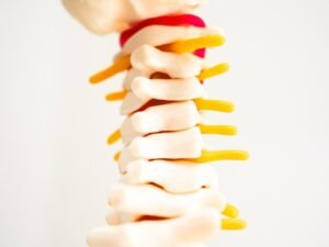 Hernia de disco abaulada tratamento Sao Paulo