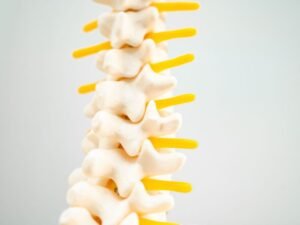 Hernia de disco cervical tratamento SP