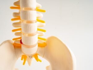 Hernia de disco lombar tratamento Sao Paulo