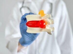 Hernia de disco tem cura Sao Paulo