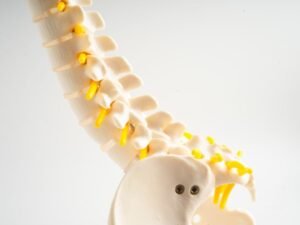 Hernia de disco toracica Sao Paulo