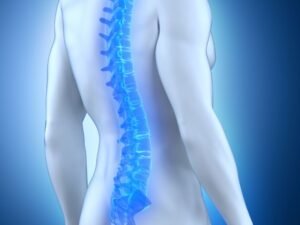 Implante epidural neuroestimulador SP
