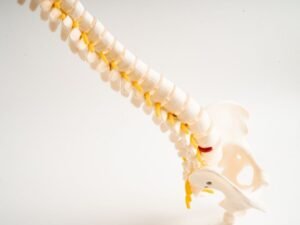 Medico especialista em hernia de disco Sao Paulo