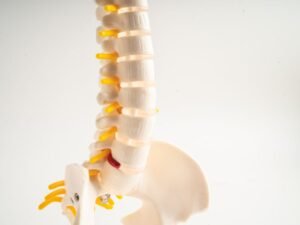 Neurocirurgiao especialista em hernia de disco SP