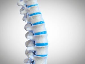 Neurocirurgiao para protusao discal SP