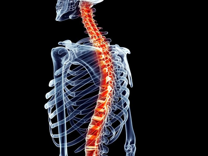 Neurocirurgiao referencia em coluna SP