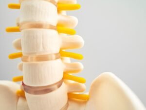 Tratamento urgente para hernia de disco SP